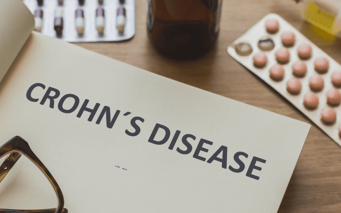 How medical marijuana can help Crohn's disease